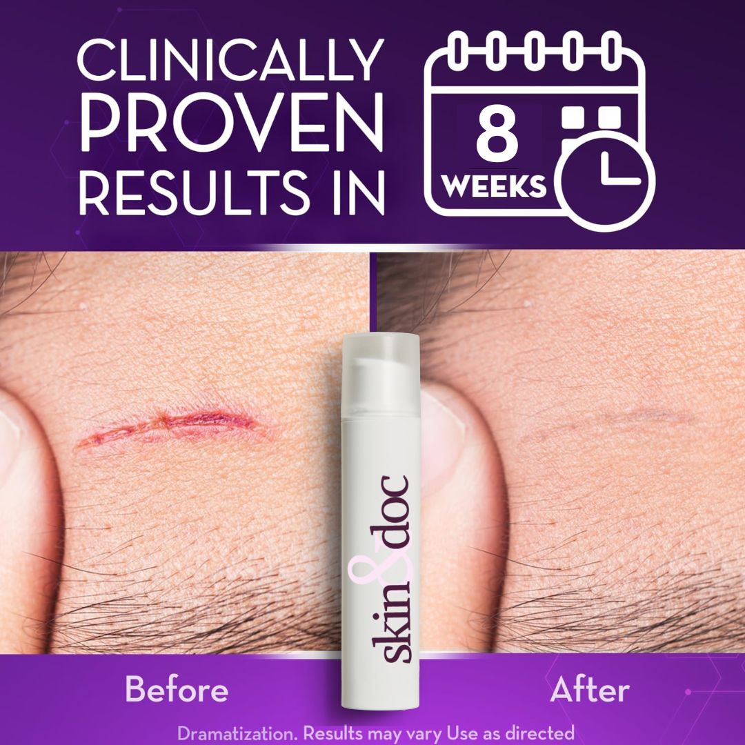 Skin & Doc Advanced Silicone Scar Gel - Clinically Proven Scar Reduction