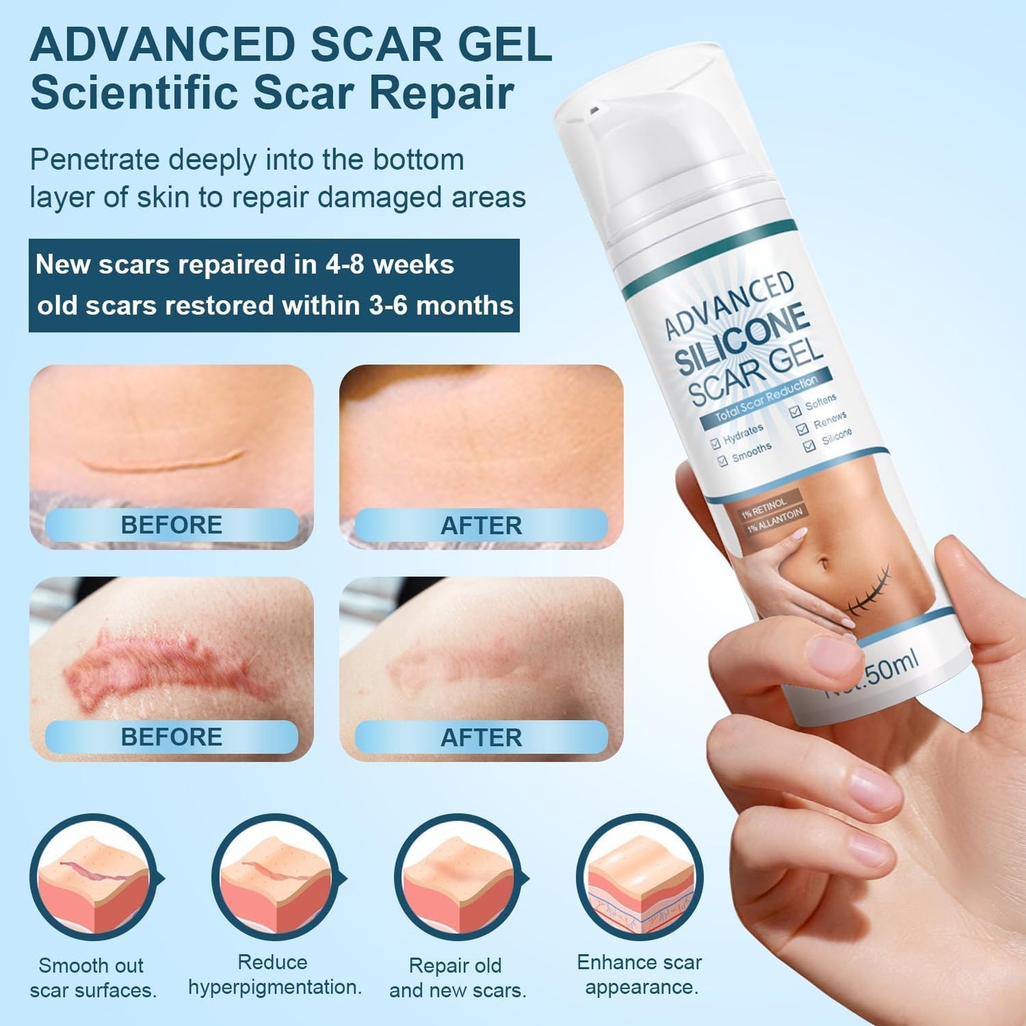 Skin & Doc Advanced Silicone Scar Gel - Clinically Proven Scar Reduction