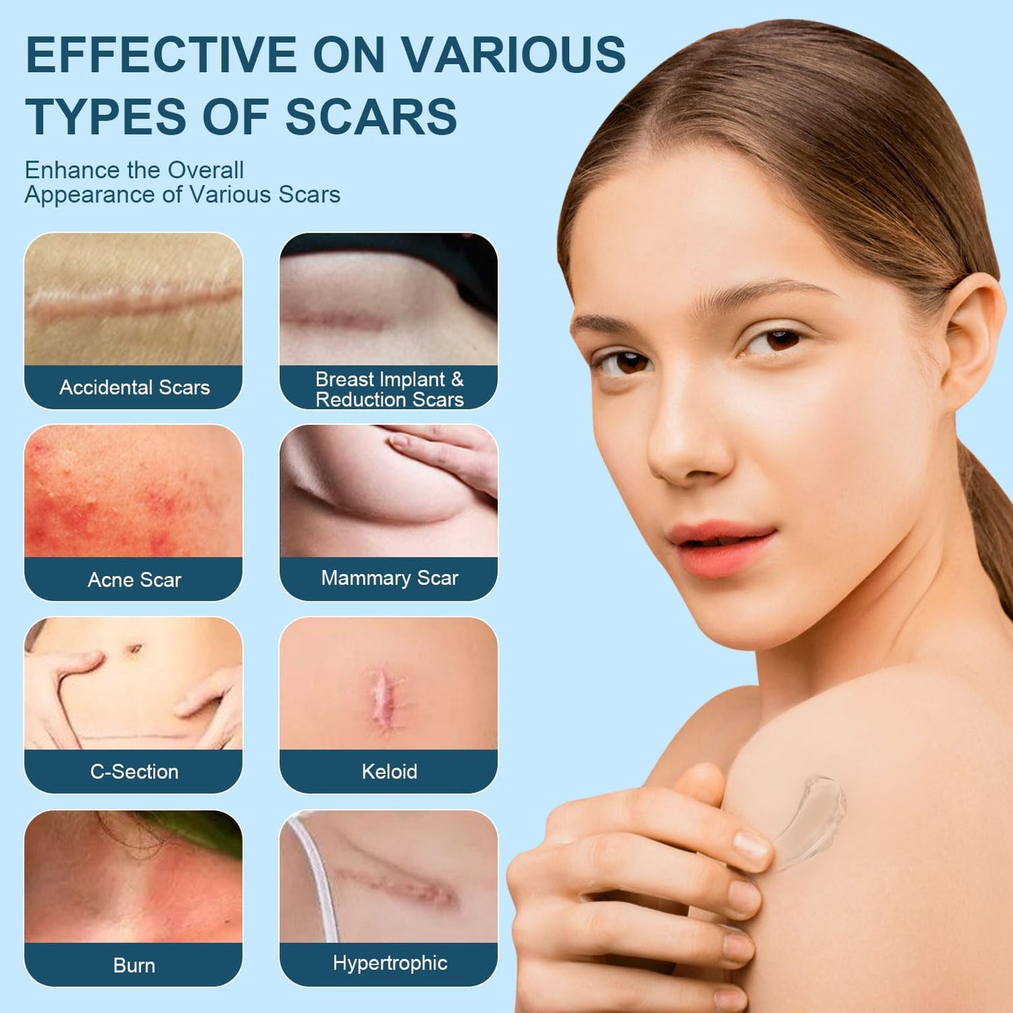 Skin & Doc Advanced Silicone Scar Gel - Clinically Proven Scar Reduction