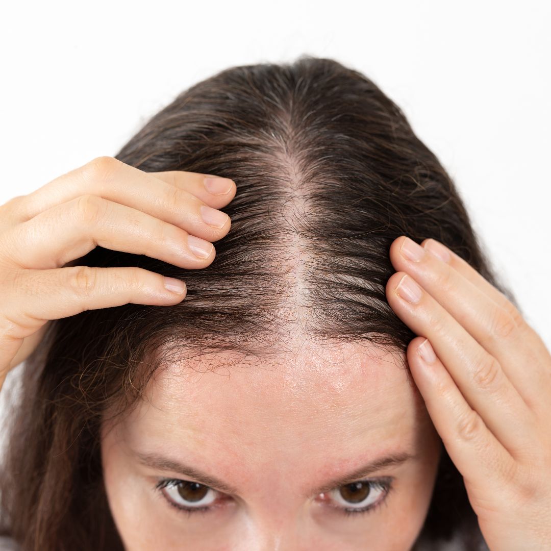 Hair Loss Treatment Plan