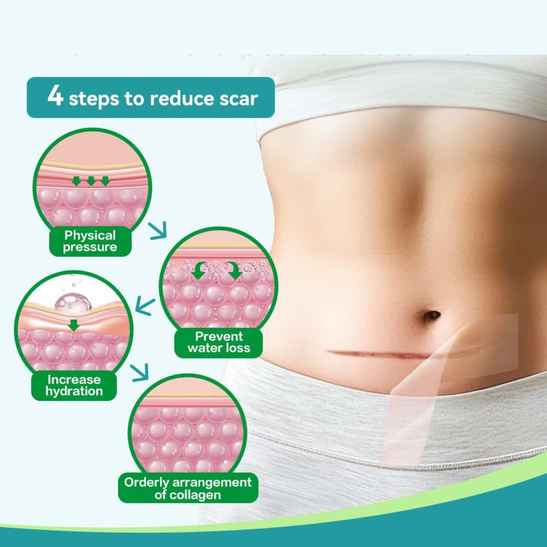 Skin & Doc Silicone Scar Removal Sheets - Fades Surgical, C-Section, Burn & Acne Scars