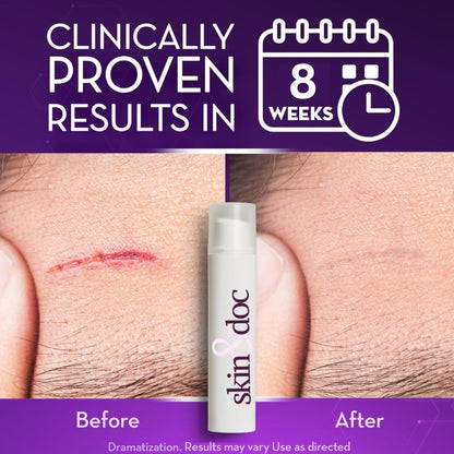 Skin &amp; Doc Advanced Silicone Scar Gel - Clinically Proven Scar Reduction