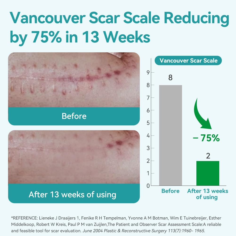 Skin & Doc Silicone Scar Removal Sheets - Fades Surgical, C-Section, Burn & Acne Scars