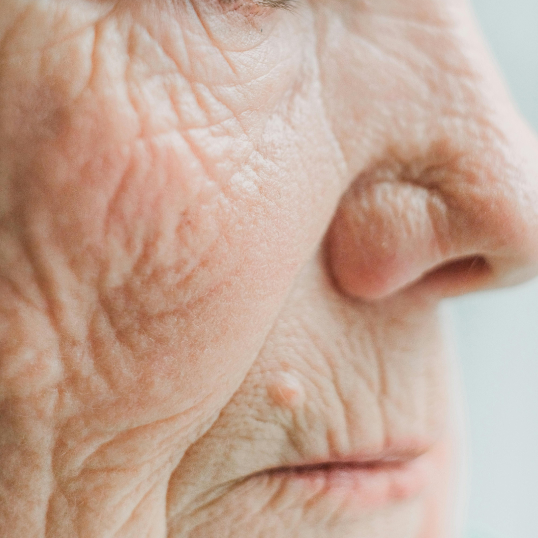 Anti-Aging Skin Treatment Plan
