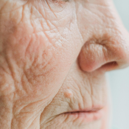 Anti-Aging Skin Treatment Plan