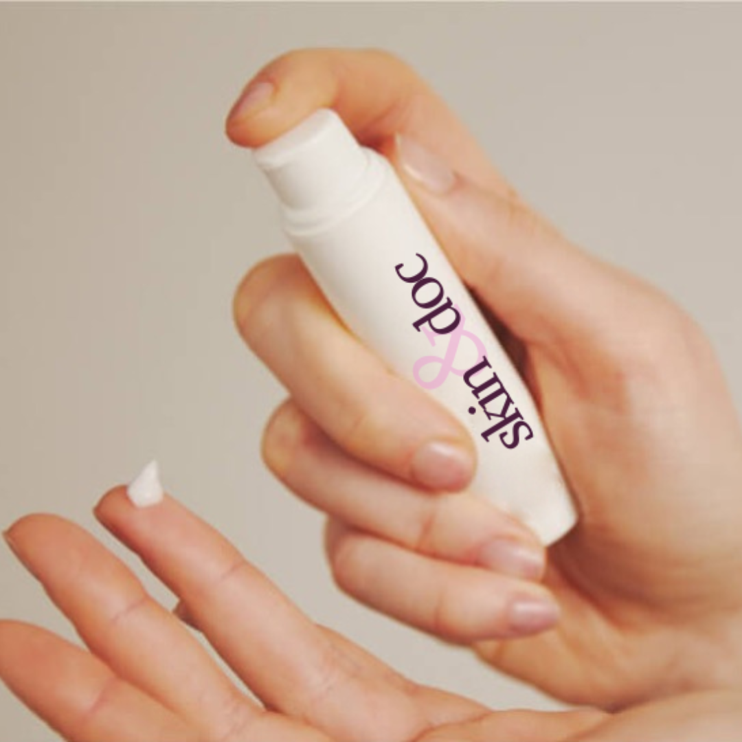 Acne Treatment Plan